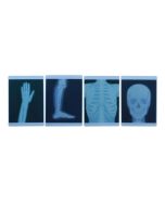 X-Ray Film 4 Piece Set